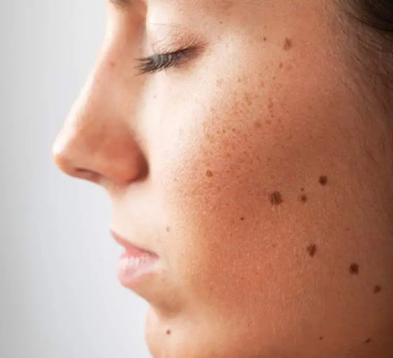 Red dots on your skin: Causes and what they could mean