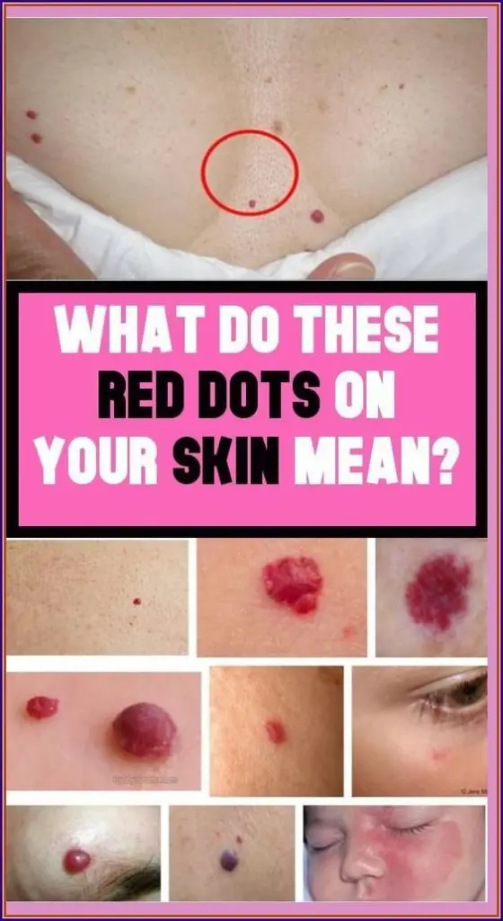 Red dots on your skin: Causes and what they could mean