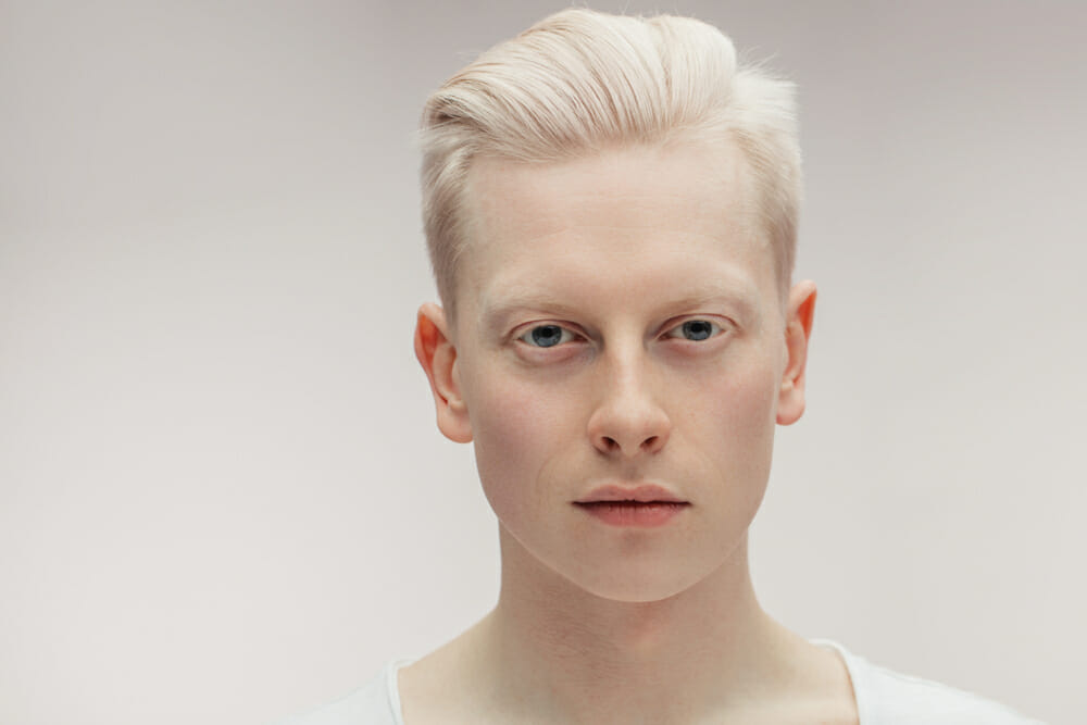 Albino sisters born 12 years apart become modeling sensations